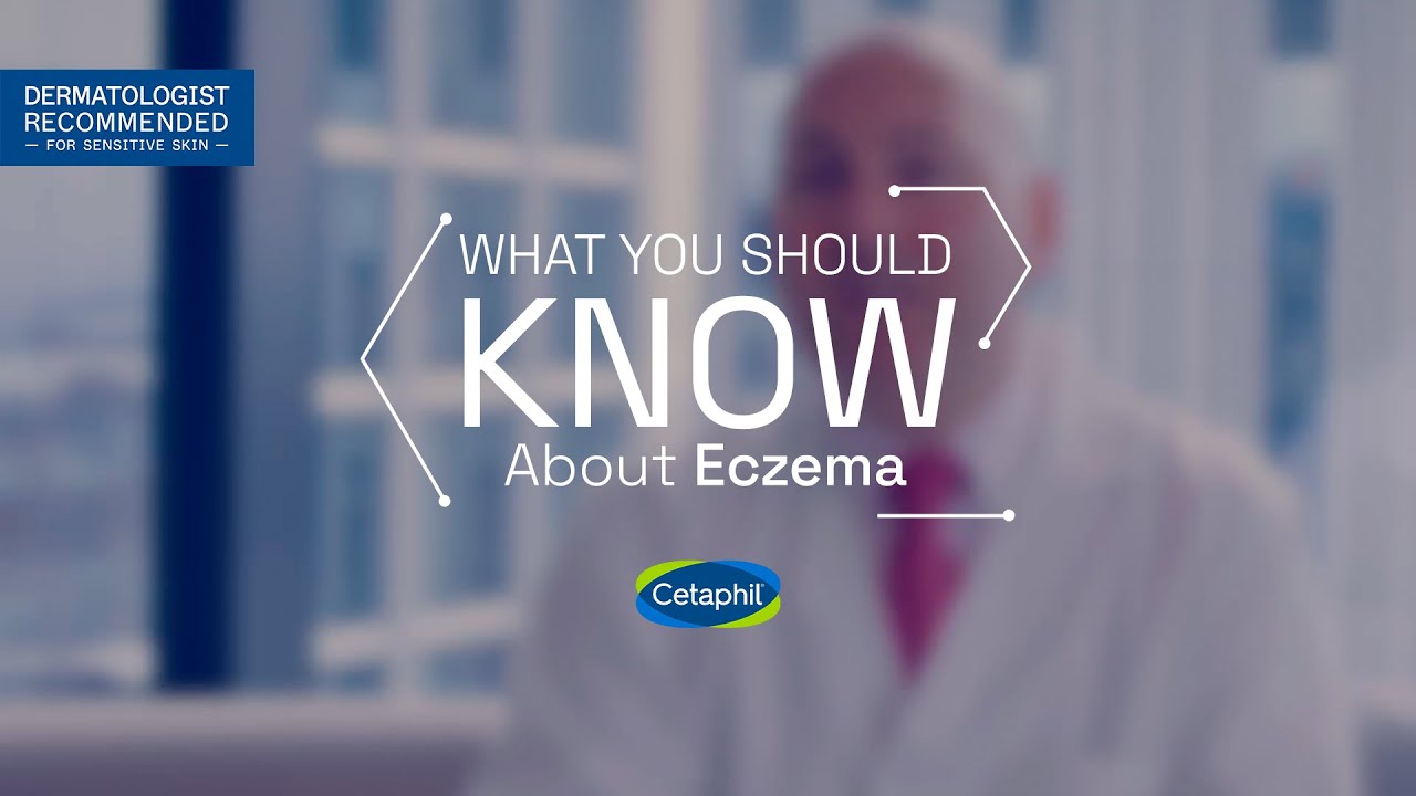 What You Should Know About Eczema | Ask the Experts​