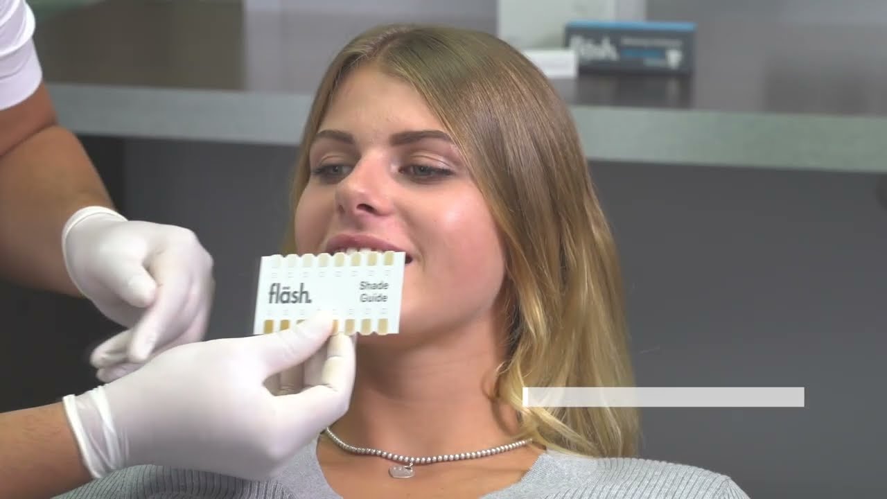 Fläsh rendelői fogfehérítés lépésről-lépésre