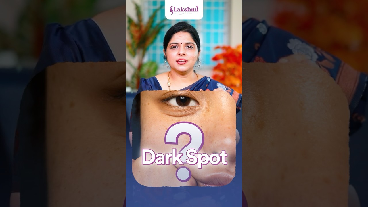 Dark Spots on Face? Do&rsquo;s & Don&rsquo;ts for Clear Skin | Dermatologist Explains in Tamil