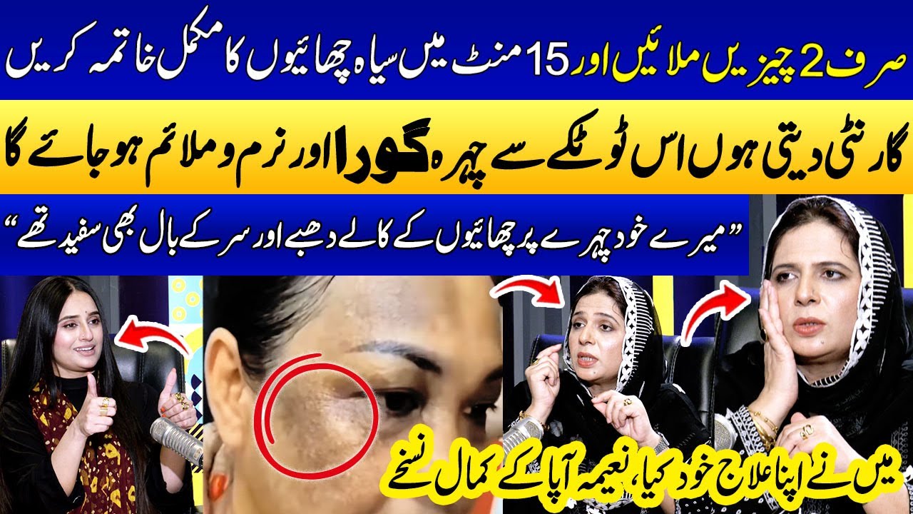 Chehre Ki Chaiyon ka Ilaj (100% Working)🌟 | Treatment of Skin Wrinkles by Naima Apa! | Ukasha Gul