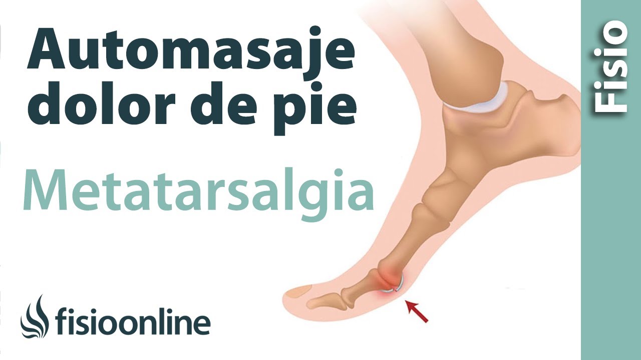 Automasaje para el dolor articular del pie - Metatarsalgia