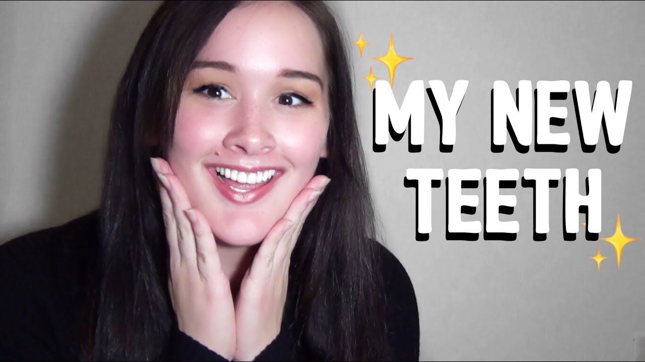 MY DENTAL IMPLANT SURGERY  | Bethany Wilhelm