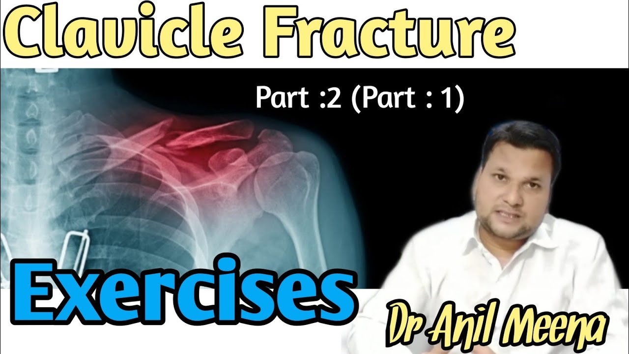 Clavicle Fracture Physiotherapy exercise | clavicle Fracture Exercises |  Collar Bone   | Hindi