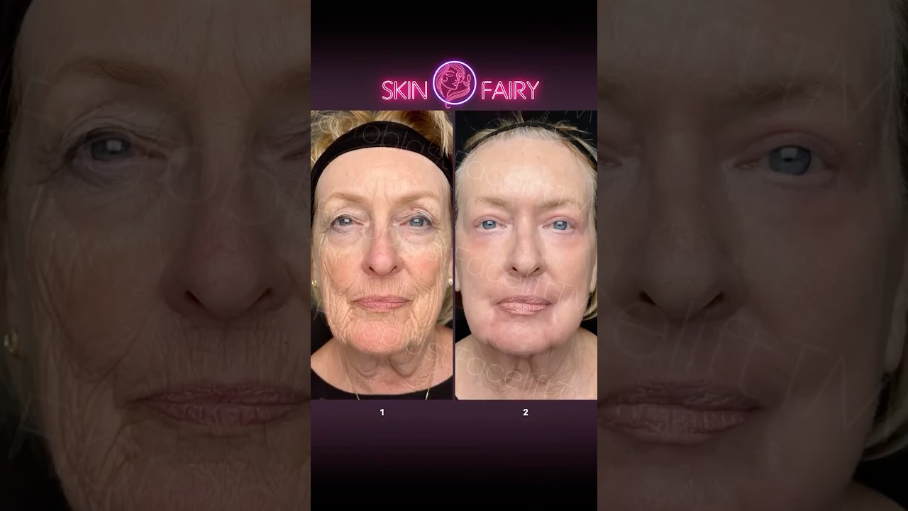 Age? What Age?! Watch this 80-Year-Old Turn Back Time in One Session