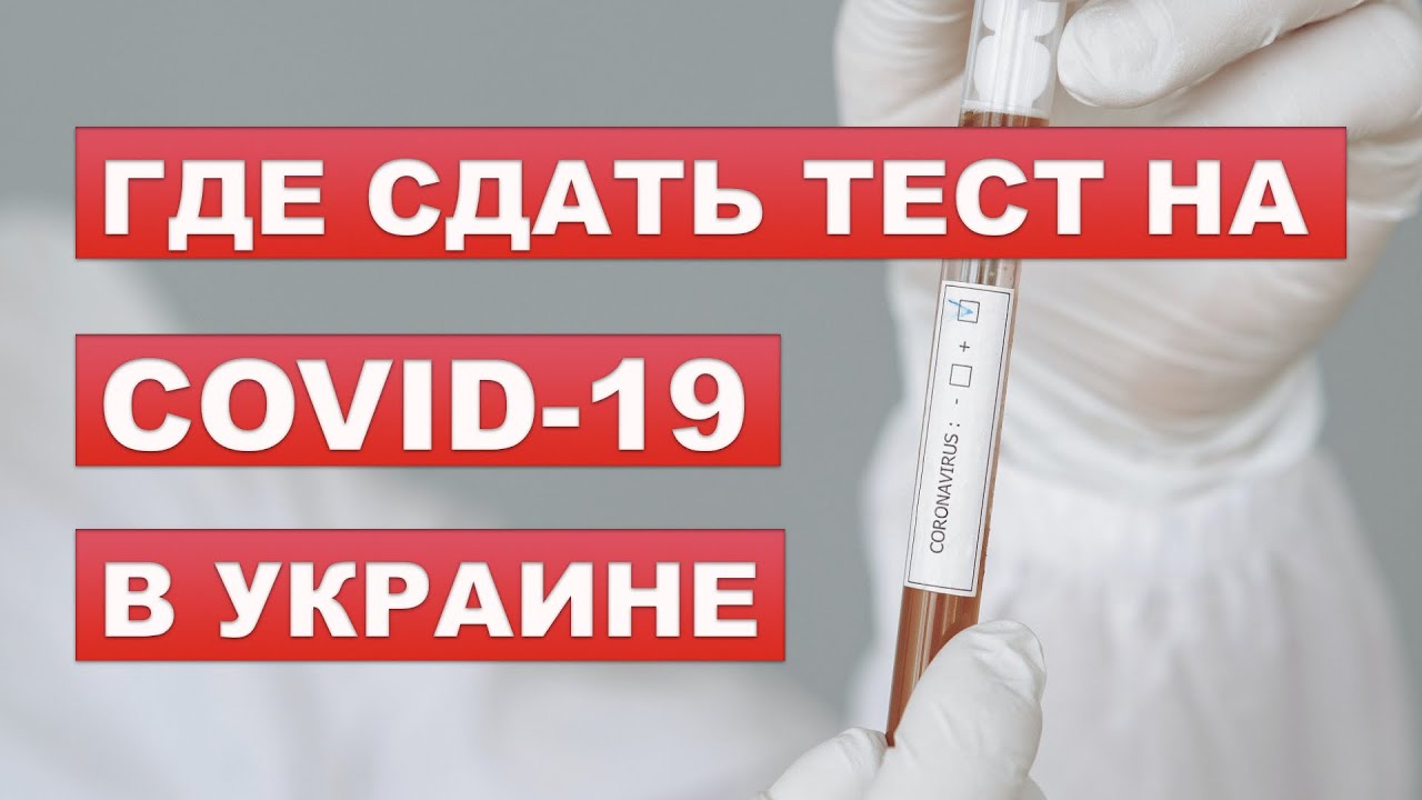 Где сдать тест на коронавирус: мед. центры, цены и сроки #тестнакоронавирус #тестынаковид