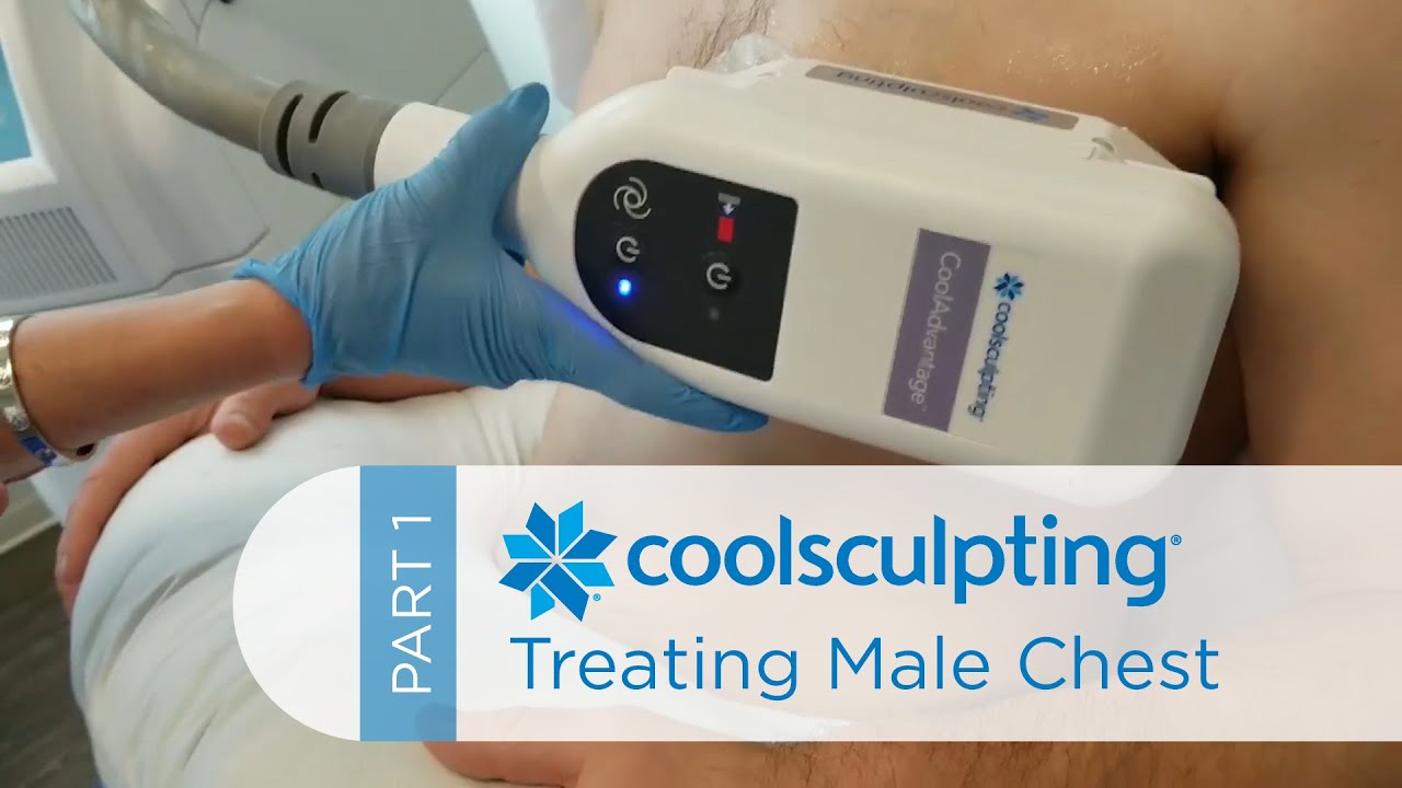 CoolSculpting Treatments for Men: Male Chest (Part 1)