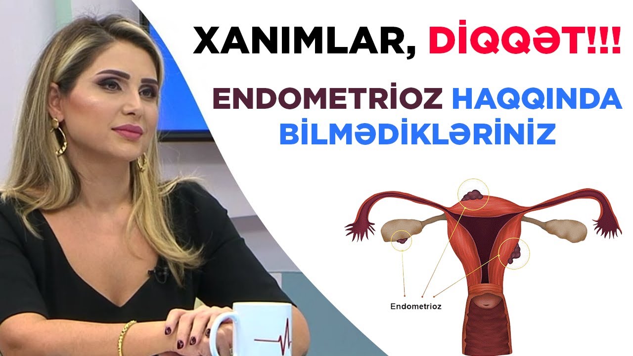 XANIMLAR, DİQQƏT! ENDOMETRİOZ haqqında bunları bilirsinizmi?