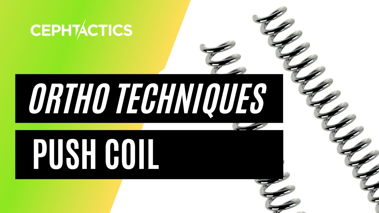Push Coil (Open Coil) in Orthodontics