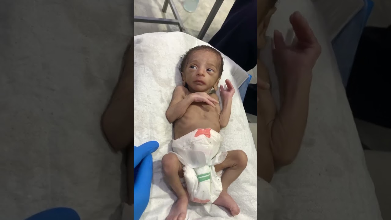 physioo #baby #neonatologist #cuteanimal #newborn #premature #cutebaby
