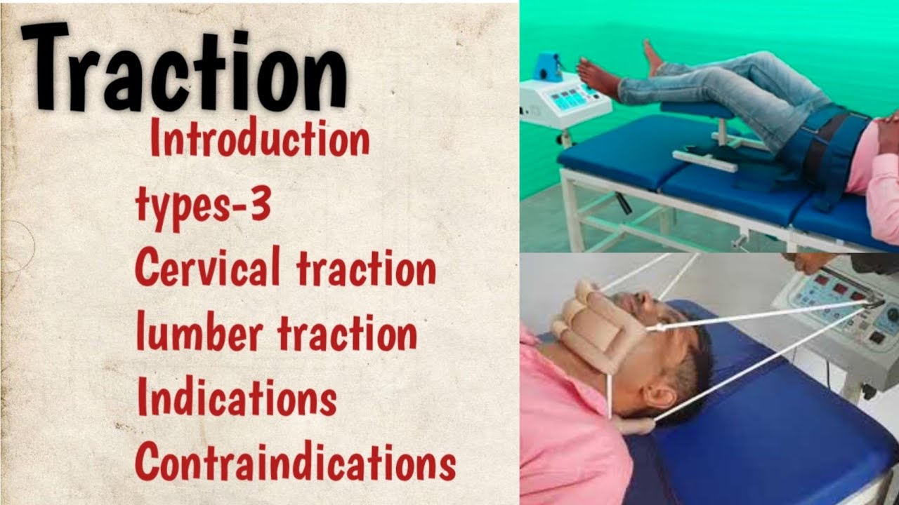 Traction - Cervical, Lumber In physiotherapy Notes