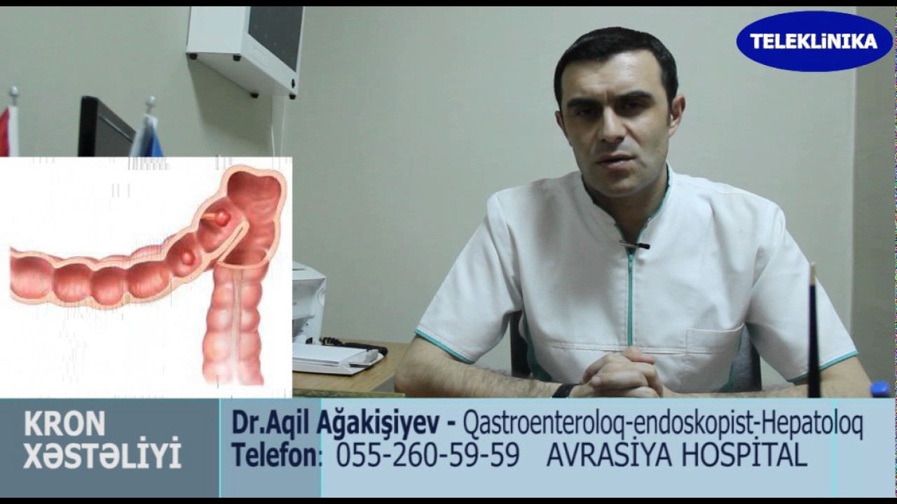 Diqqet!. Kron Xesteliyi. Dr.Aqil Ağakişiyev. Qastroenteroloq-hepatoloq