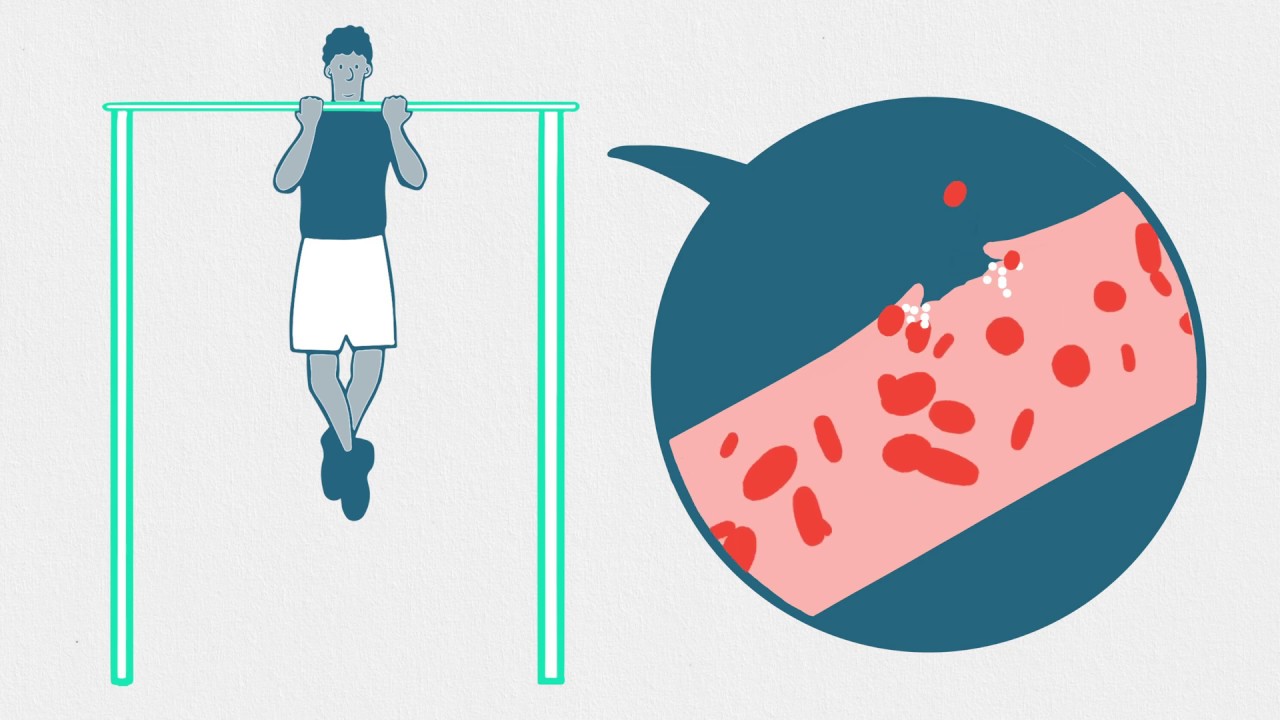 Haemophilia | Advice for Personal Trainers | Project GYM