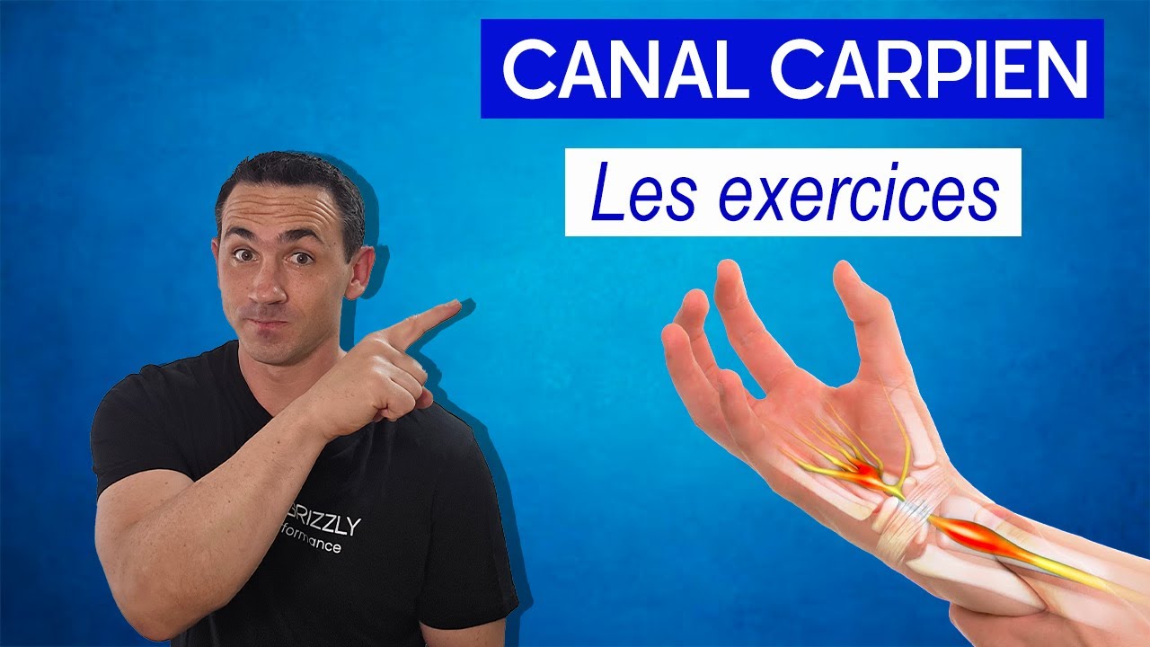 Soulager le Syndrome du Canal Carpien : Symptômes, Exercices et Massage