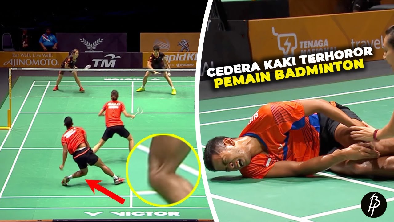 Bikin Merinding..!! Inilah Cedera Kaki Terhoror Dalam Laga Badminton, Ada Yang Gak Bisa Sembuh