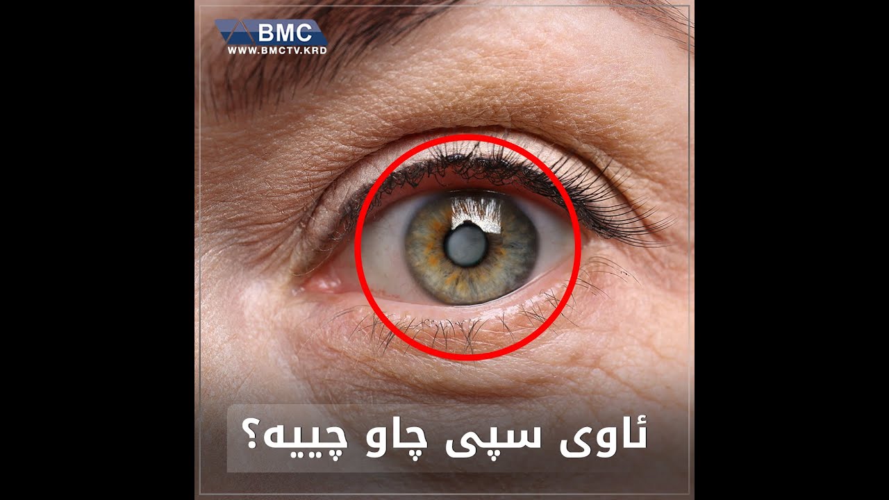 ئاوی سپی چییە؟ چ کاتێک مەترسیدارە و پێویستی بە عەمەلیاتە؟