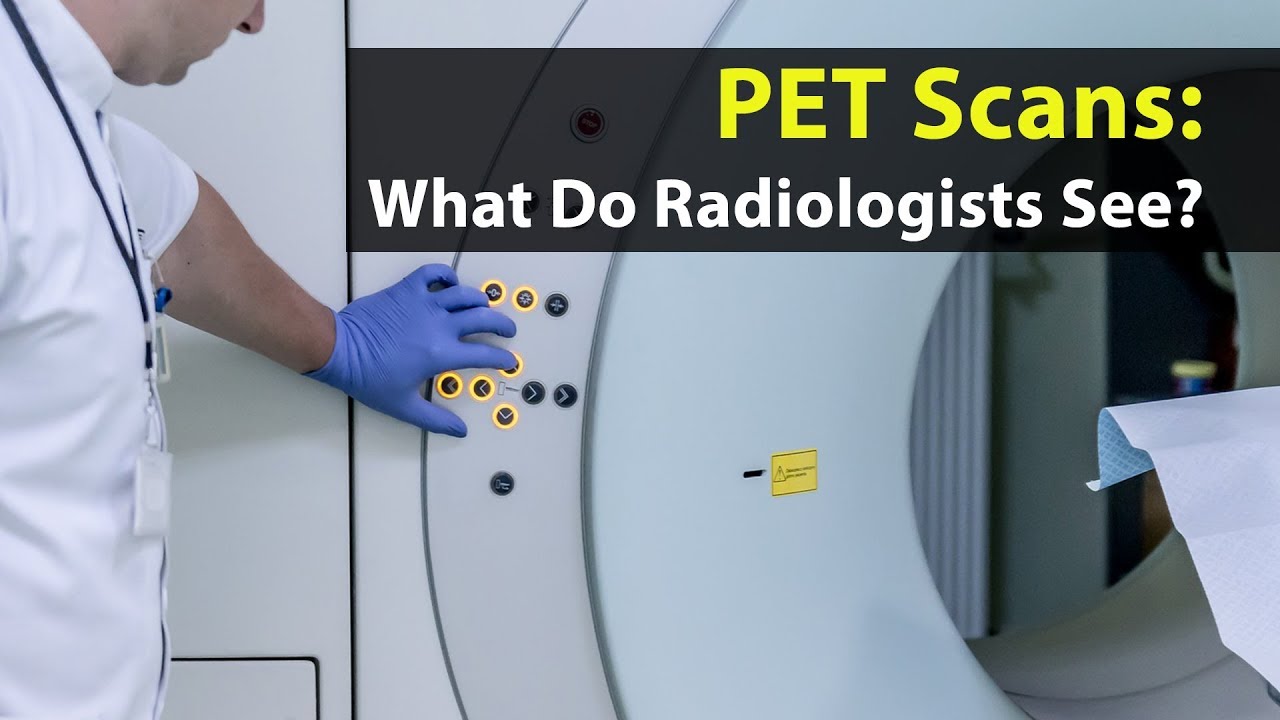 PET Scans: What Do Radiologists See?