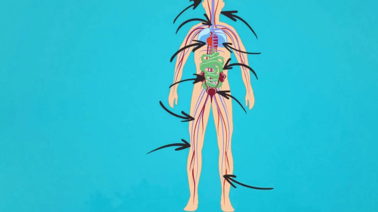 What is POTS?   Dysautonomia International 2016