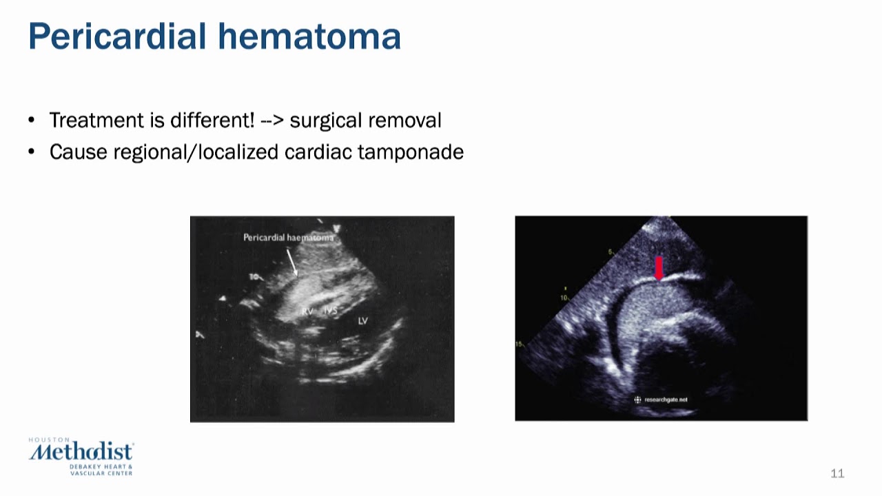 Multi-Modality Conference: Cardiac Emergencies - Lakshmi Chebrolu, MD