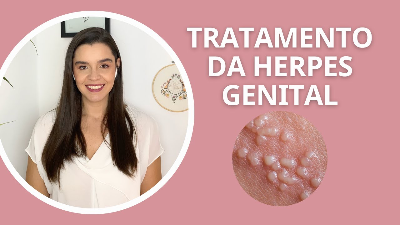Tratamento da herpes genital, como tratar herpes genital