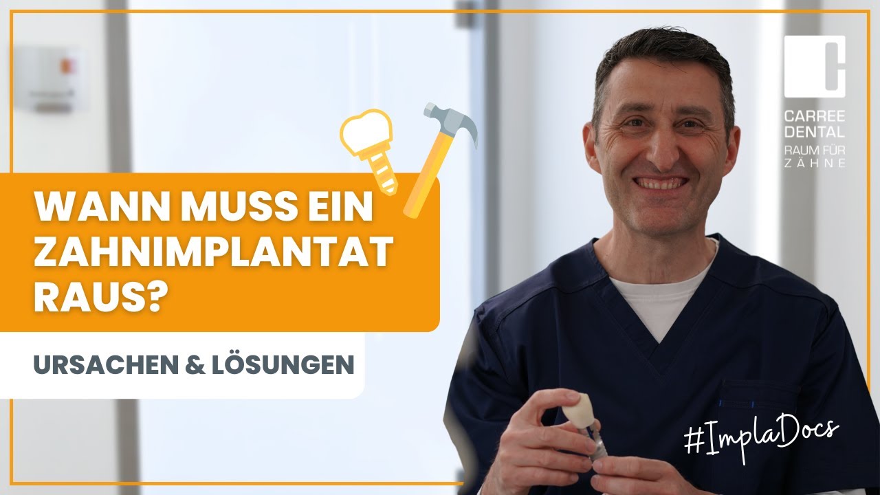 Wann muss ein Zahnimplantat raus? H&auml;ufige Ursachen und L&ouml;sungen | Carree Dental K&ouml;ln