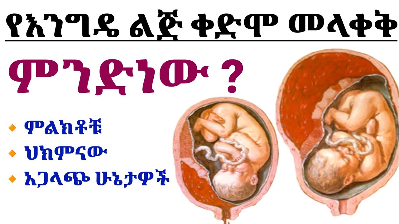የእንግዴ ልጅ ቀድሞ መላቀቅ (placental abruption) በምን ይከሰታል ፣ ምልክቶቹ ፣ አጋላጭ ሁኔታዎች እና ህክምናው