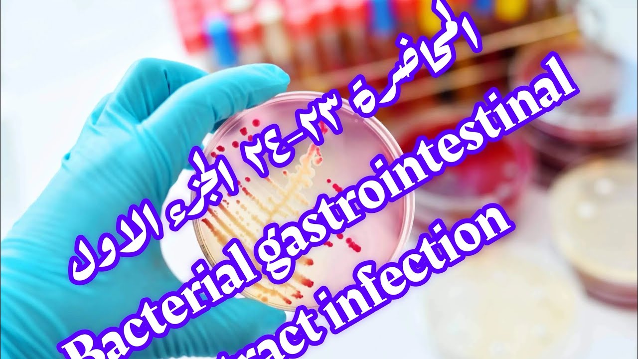 تشخيص بكتيري مرحلة رابعة المادة الوزارية المحاضرة ٢٣-٢٤ bacterial gastrointestinal tract infection