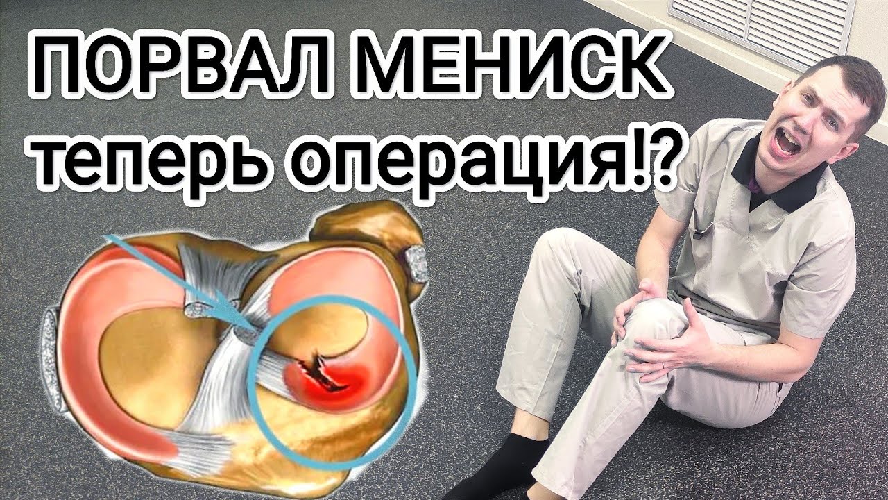 Порвал мениск. Нужна ли операция!? Что теперь делать...