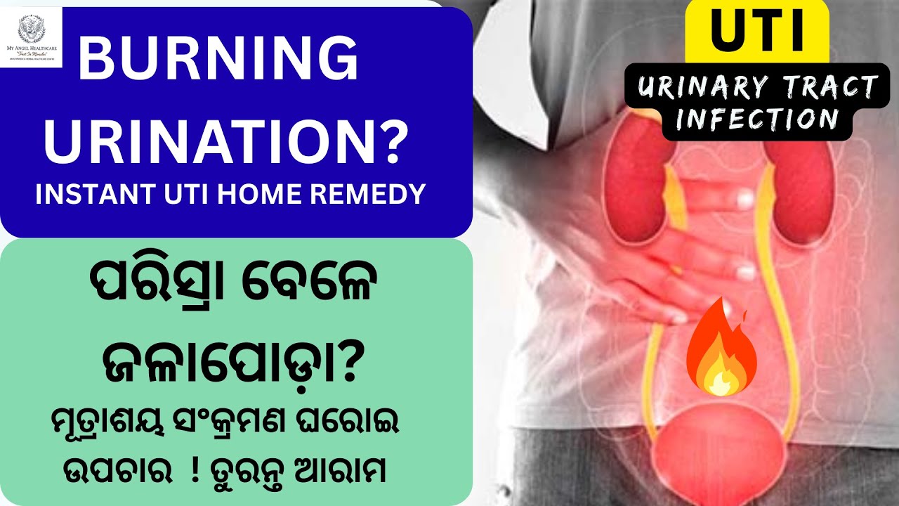 UTI Home Remedy for Instant Relief |ପରିସ୍ରା ଜଳାପୋଡା, UTI ଘରୋଇ ଉପଚାର | 