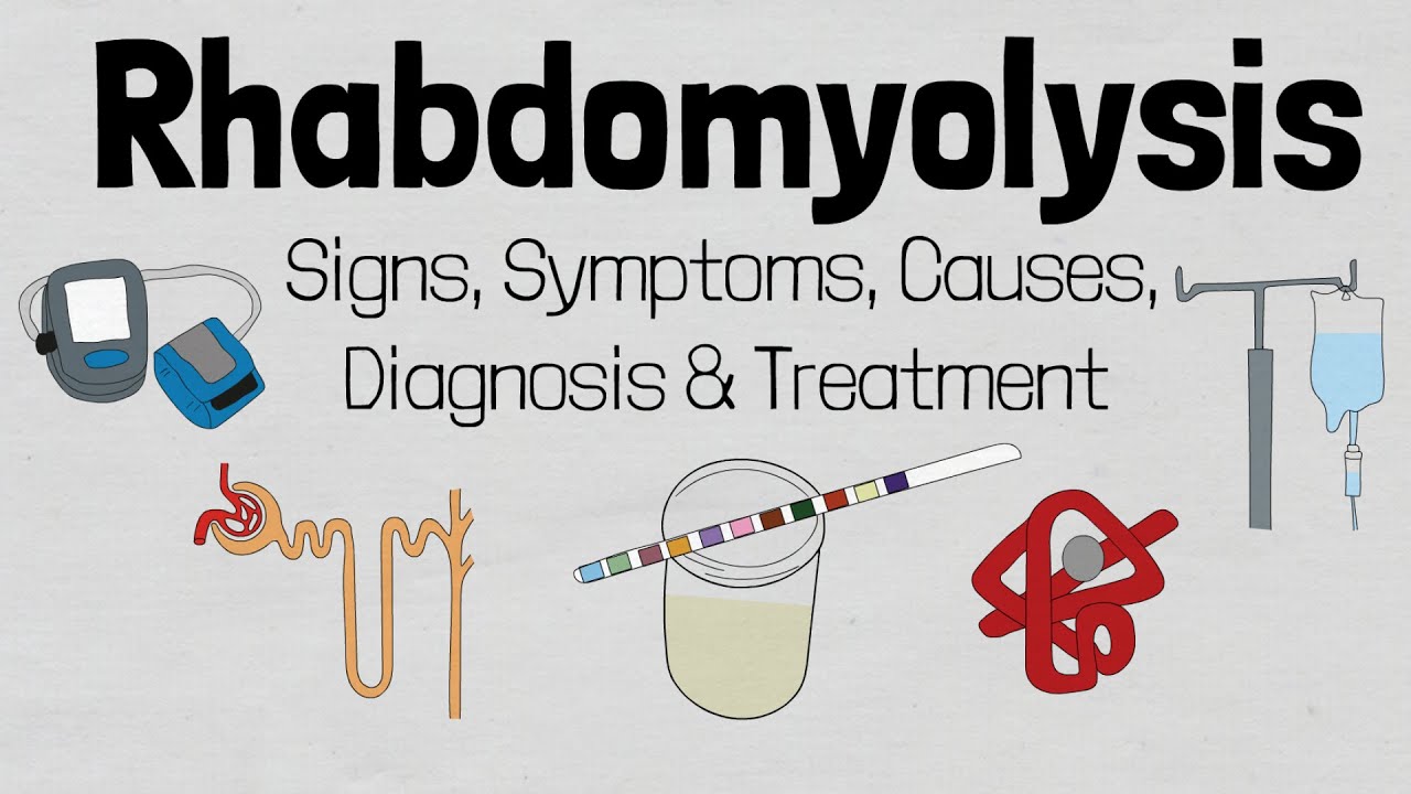Rhabdomyolysis: Causes, Signs, Symptoms, Diagnosis & Treatment