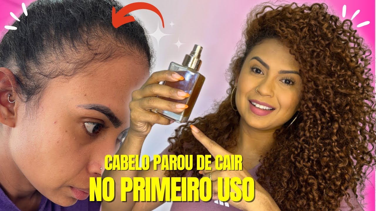 CRESCIMENTO EXTREMO!SEU CABELO NÃO ESTÁ CRESCENDO PORQUE VOCÊ NÃO EXPERIMENTOU ESTE TÔNICO MÁGICO 💯