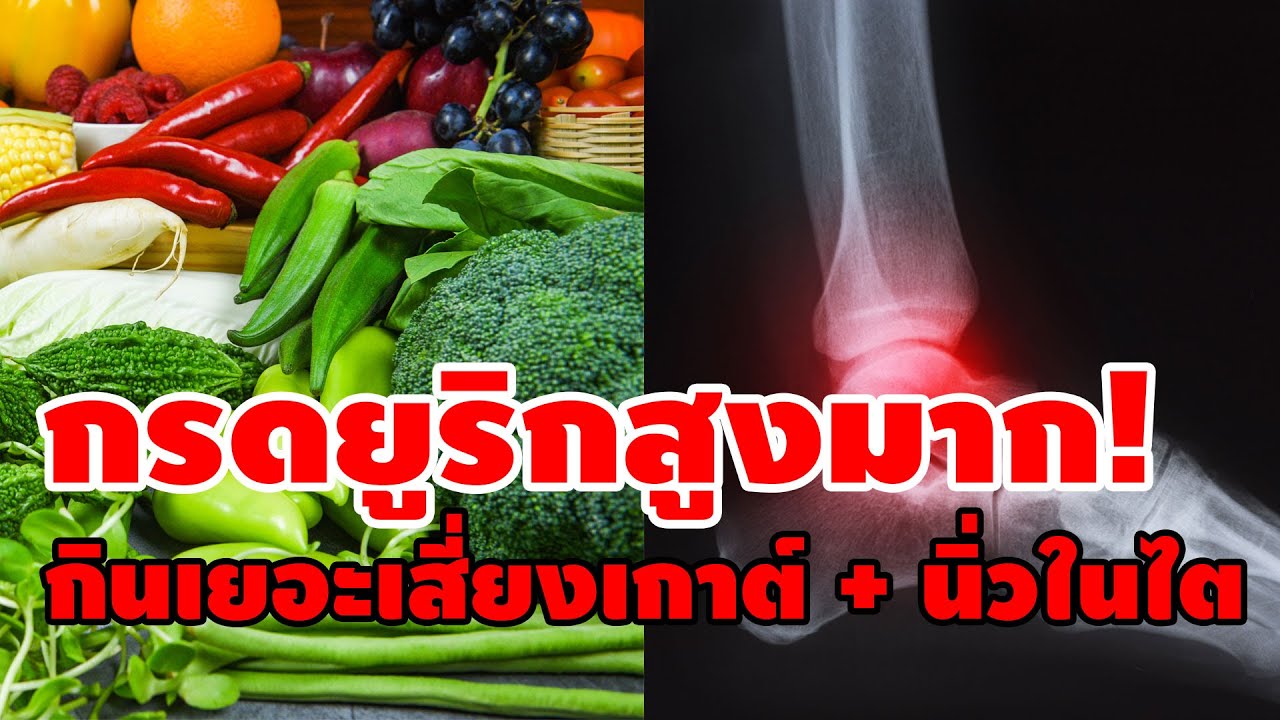 เช็คด่วน ผักชนิดใดบ้าง มีกรดยูริกสูง เมื่อร่างกายได้รับมากเกินไป จะเสี่ยงหลายโรค