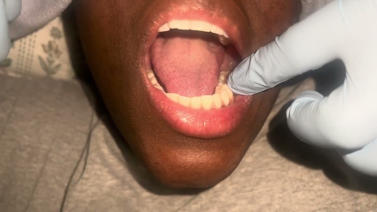 Dental Brushing and Flossing