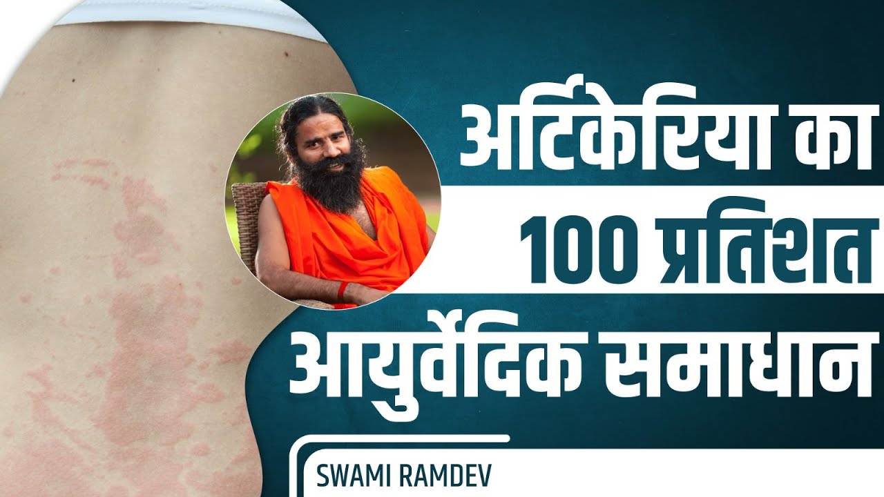 अर्टिकेरिया (Urticaria) (शीतपित्त) का 100 प्रतिशत आयुर्वेदिक समाधान || Swami Ramdev