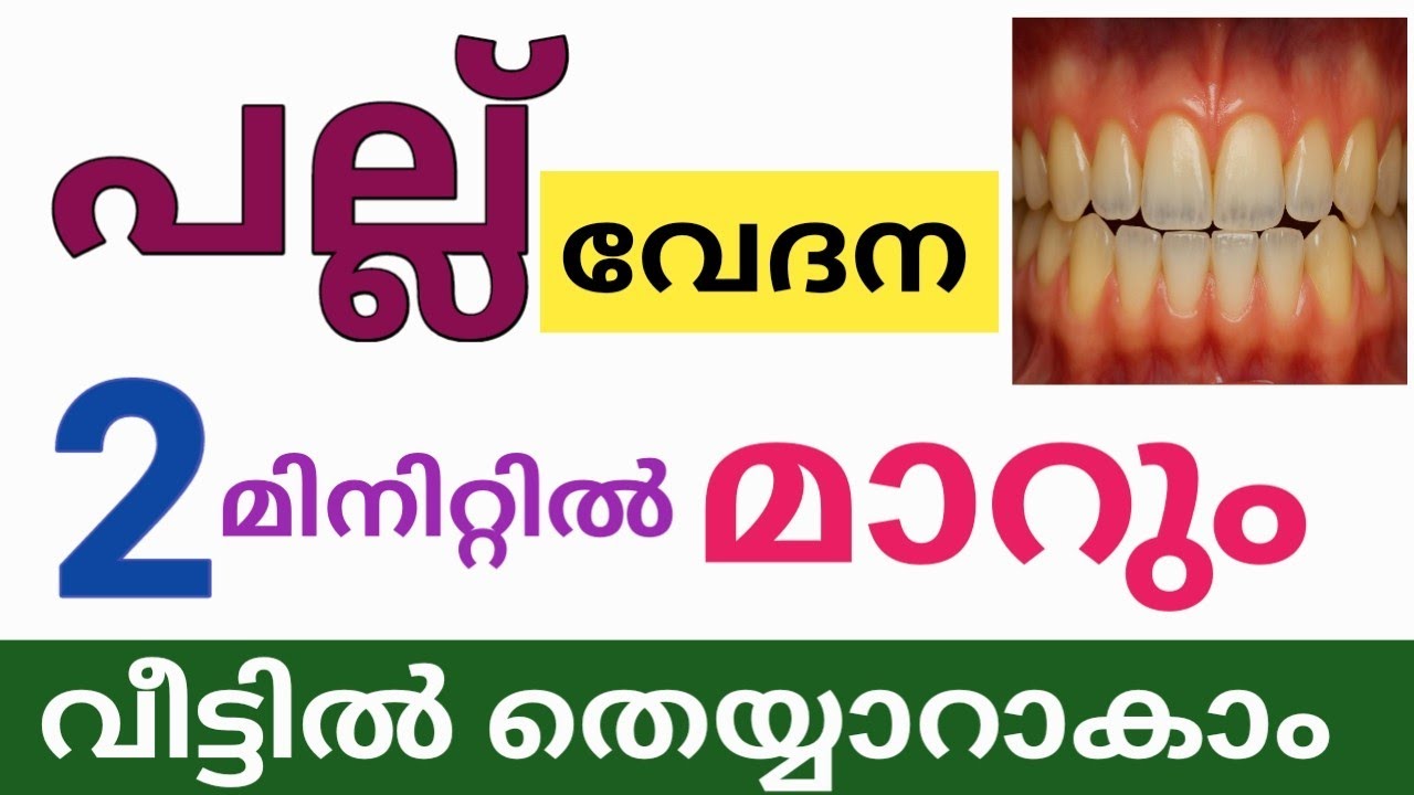 2 മിനിറ്റിൽ പല്ല് വേദന മാറ്റാം/വീട്ടിൽ തെയ്യാറാകാം /പല്ല് വേദന മാറാനുള്ള മരുന്ന് 