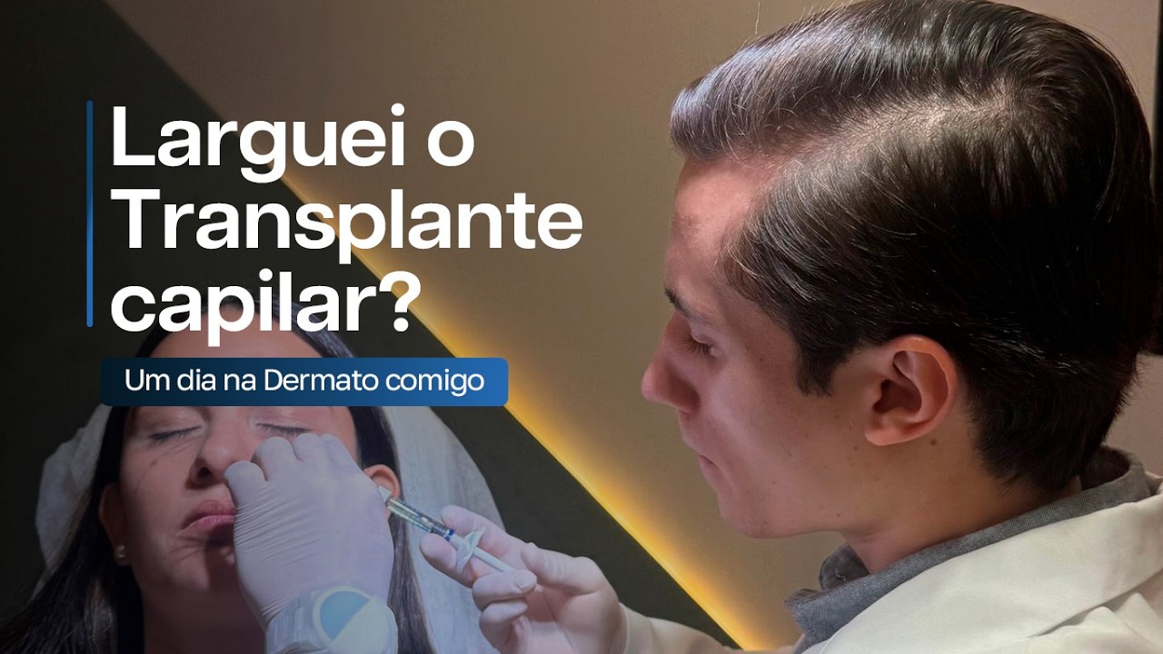 VLOG DO BRO: Ep. 7 - Larguei o Transplante Capilar e fui pra Dermato??