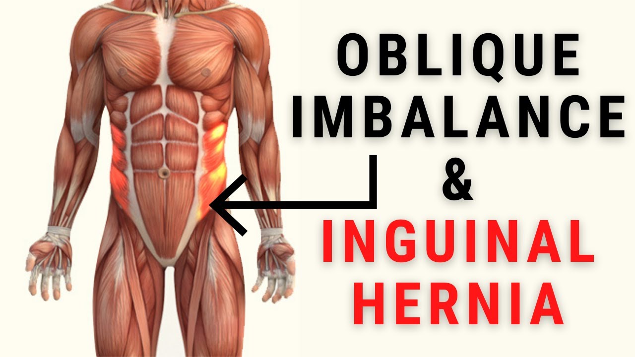 Oblique Muscle Imbalance & Inguinal Hernias