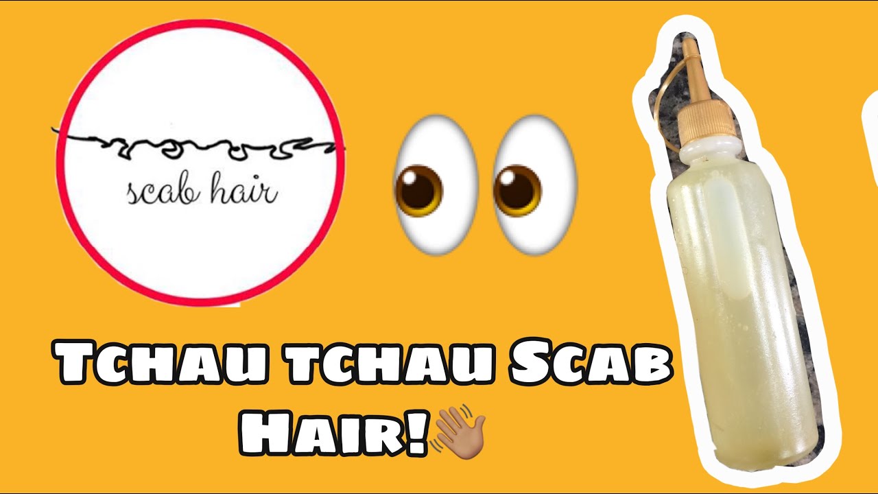 DESCOBRI O SEGREDO PARA ACABAR COM O SCAB HAIR!