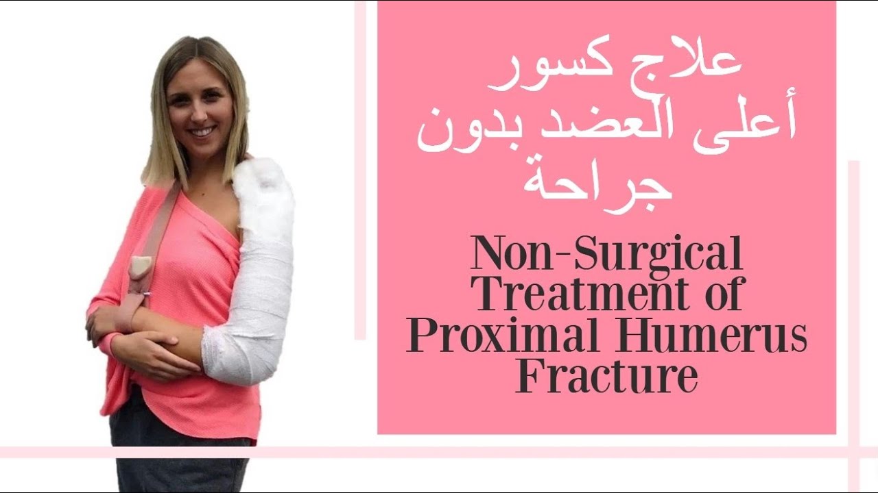 العلاج غير الجراجي لكسور العضد القريب non-surgical treatment of proximal humerus fracture