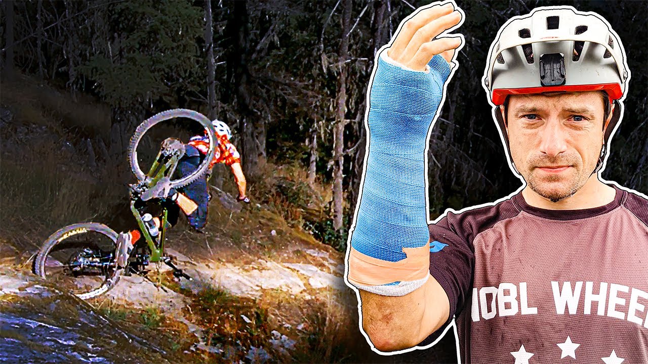 How I BROKE My Wrist By Missing One CRUCIAL Detail.