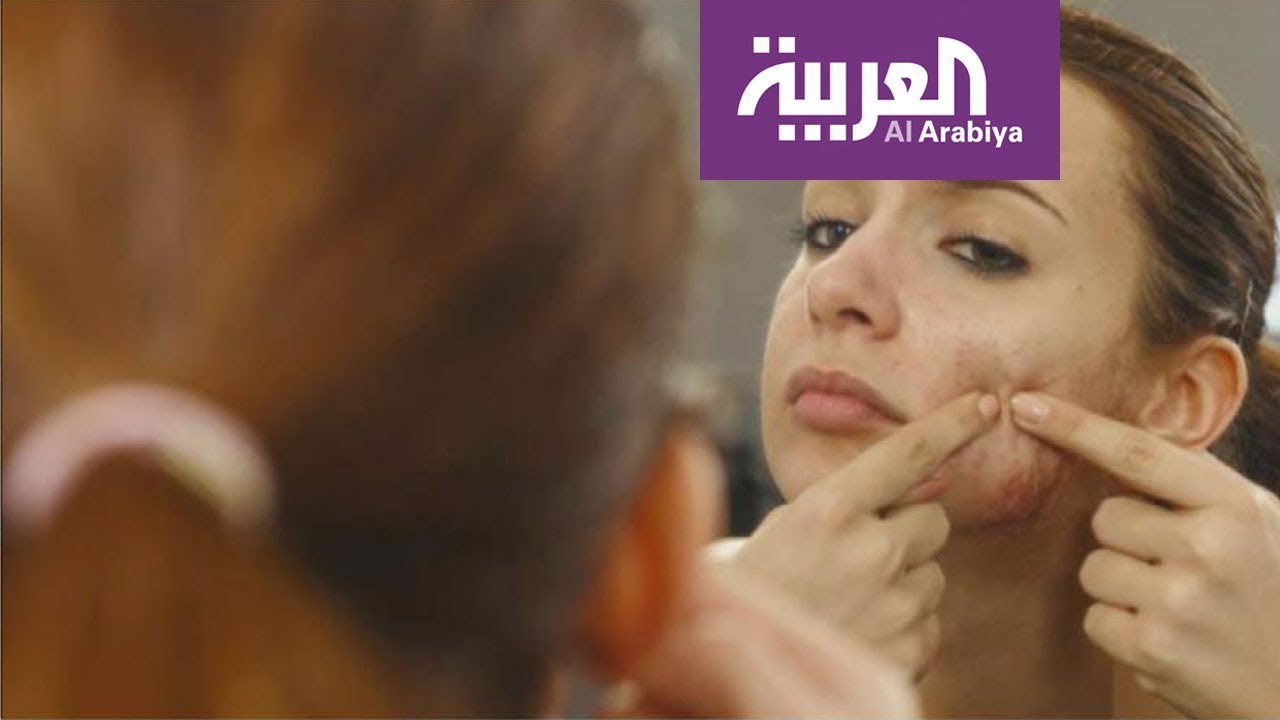 صباح العربية  احذروا ليزر إزالة آثار حب الشباب في الصيف