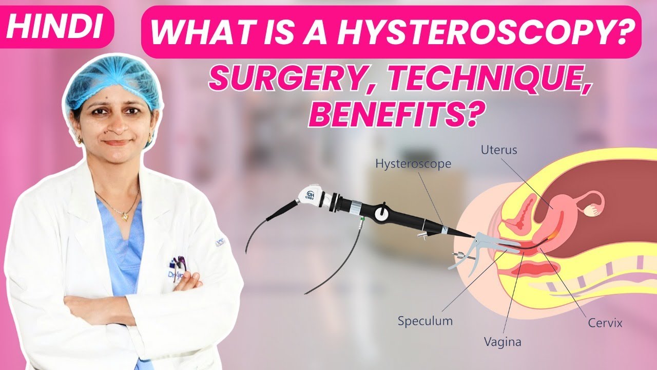 What Is a Hysteroscopy? | Surgery, Technique, Benefits? (Hindi) | Dr. Jyoti Gynecologist