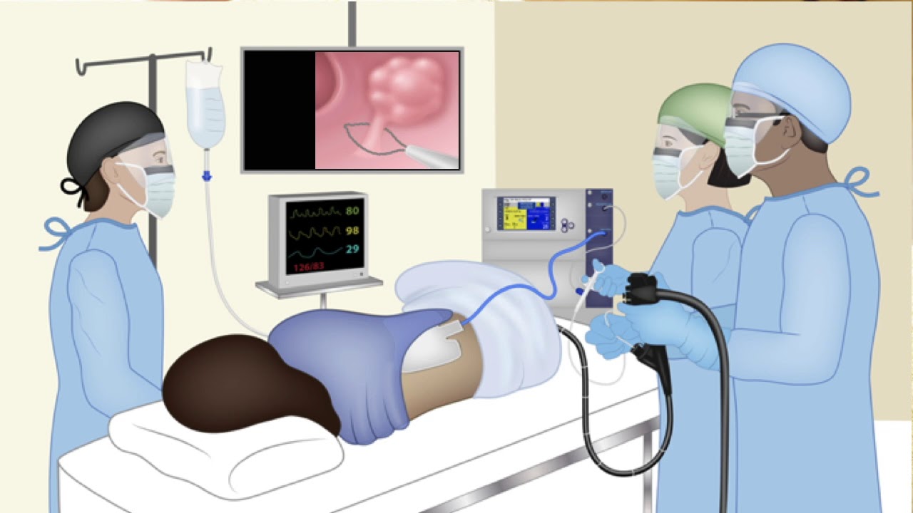 Endoscopy Tech Course: Electrosurgery - Lecture at MD Anderson Cancer Center