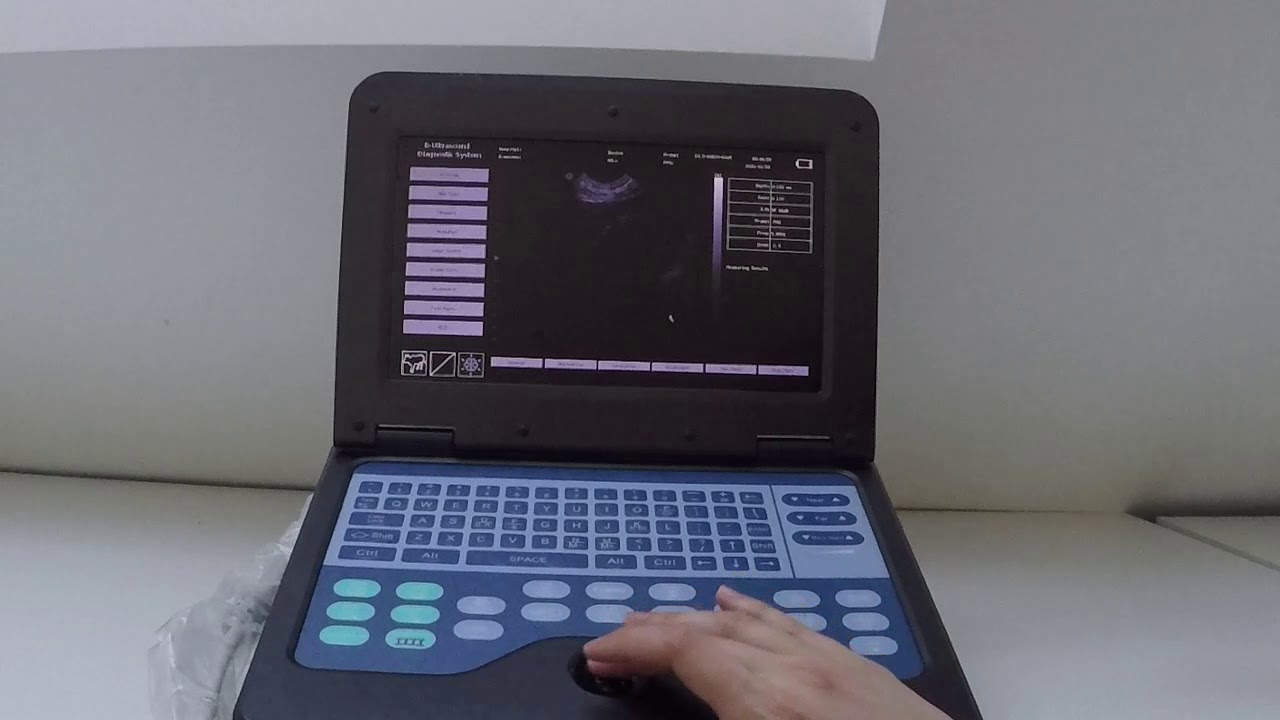 Contec CMS6000P2 Ultrasound Machine Controls