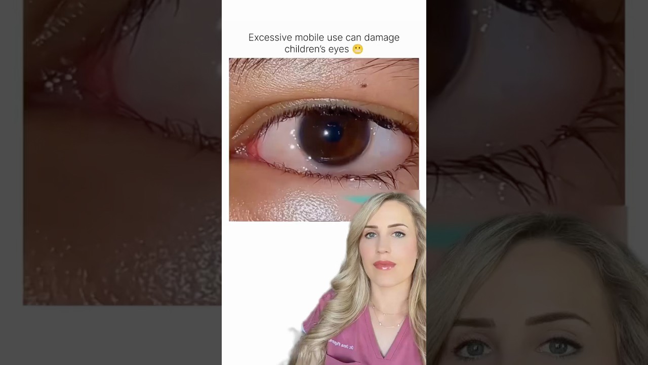 Is screen time damaging your eyes?!