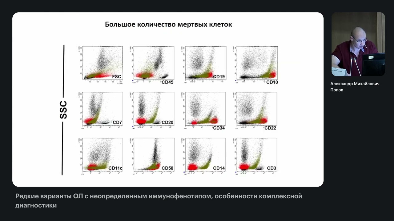 Редкие варианты ОЛ с неопределенным иммунофенотипом, особенности комплексной диагностики