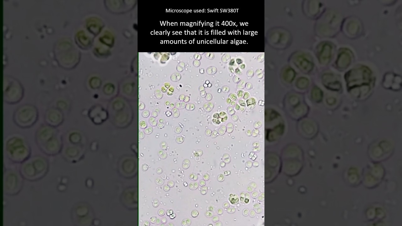 Why does water turn greenish or yellowish? Unicellular algae under the microscope. #microscopy