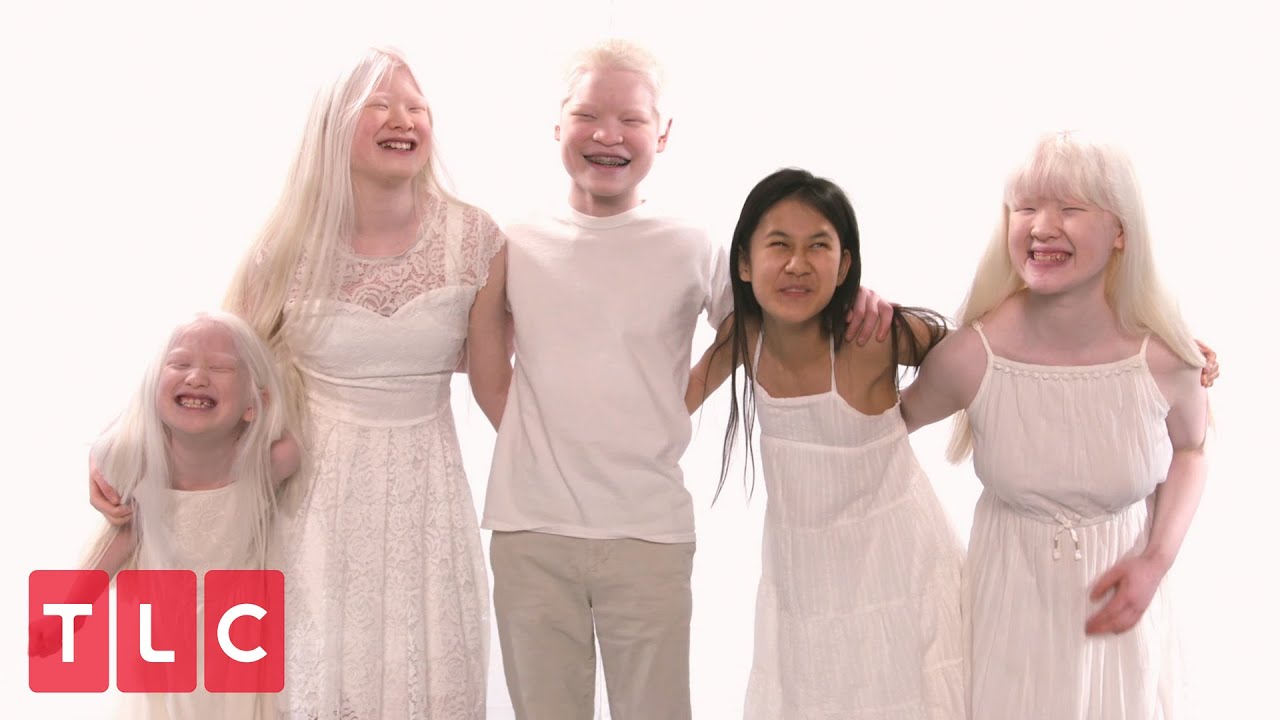The Grabowskis' Unique Adoption Story (Part 2) | Born With Albinism