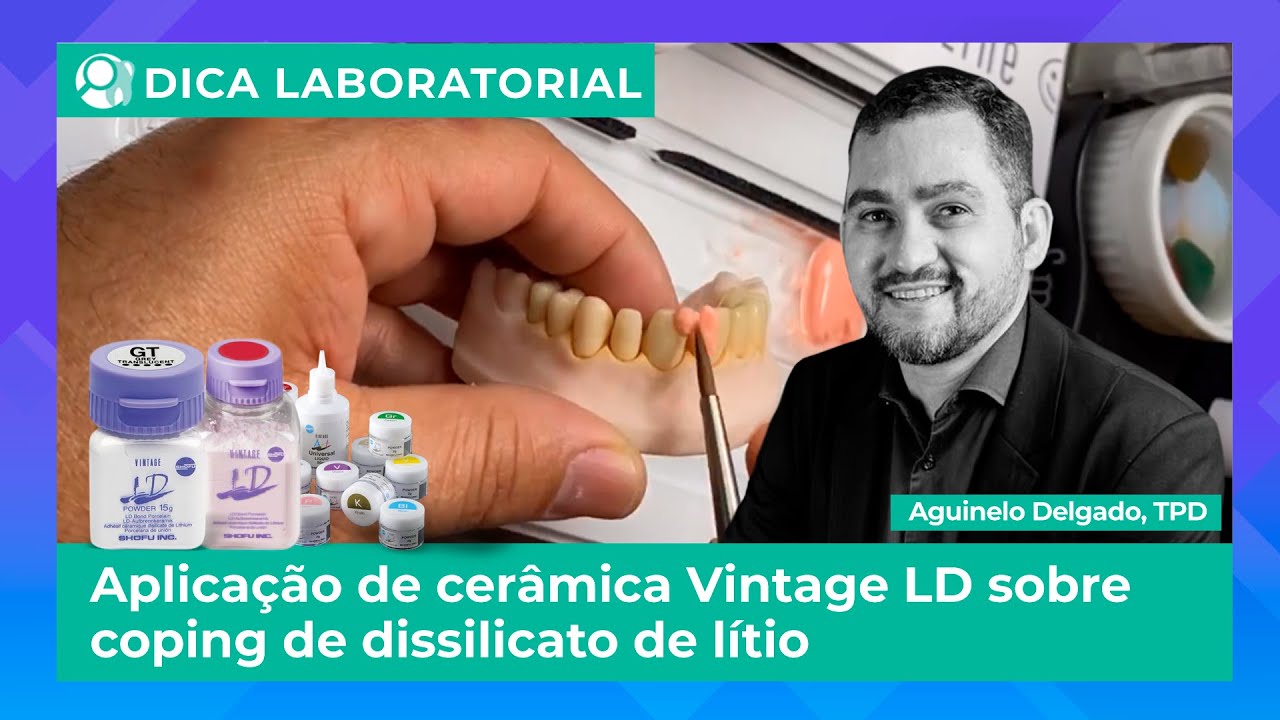 🦷Dica Laboratorial - Aplicação de cerâmica Vintage LD sobre coping de dissilicato de lítio com o TP