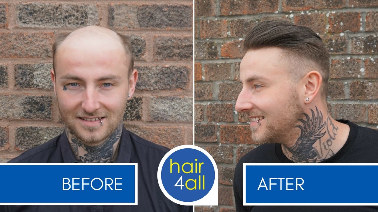 How to Apply (Attach) a Non-Surgical Hair Replacement System for Men with The Harris Brothers