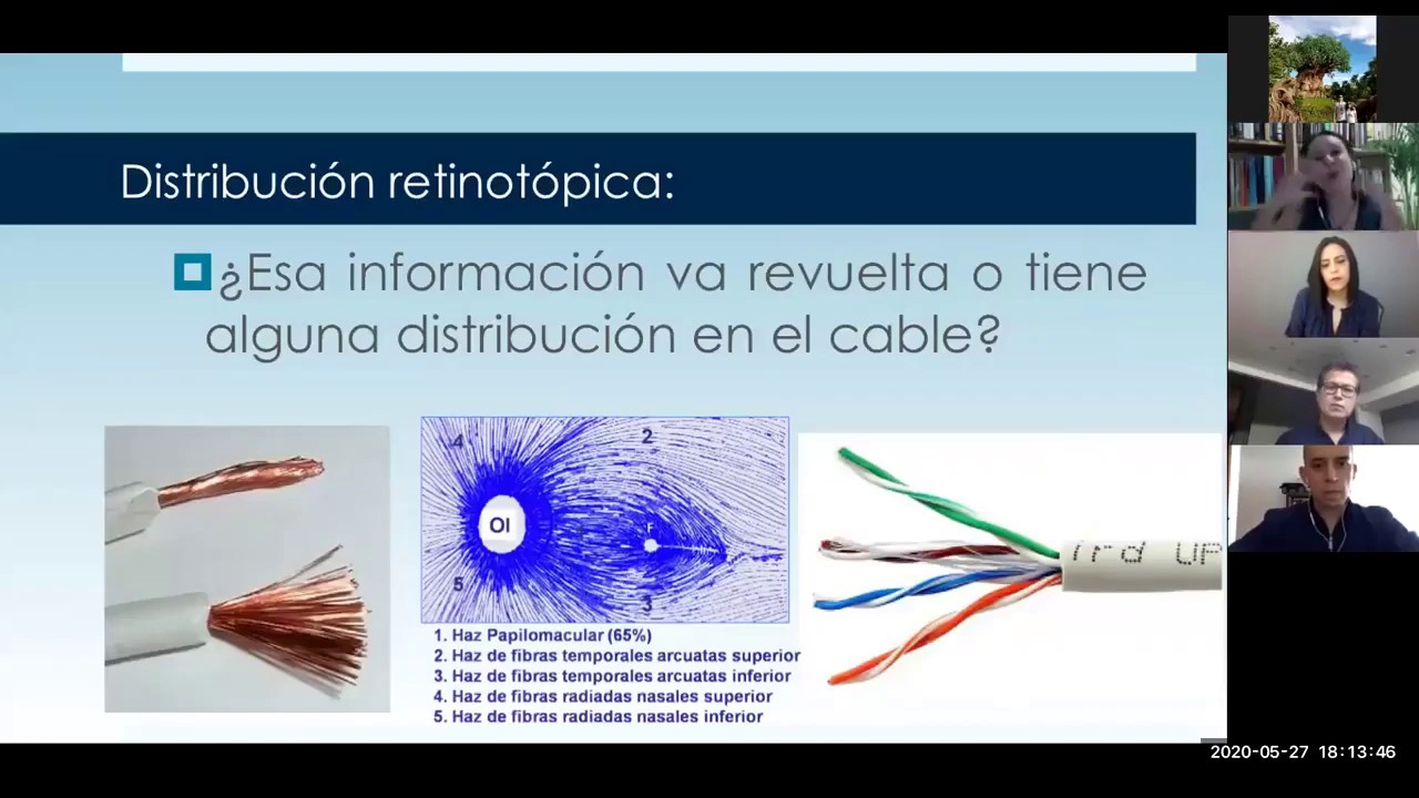 Webinar: Octopus 900 & 600 – Haag-Streit Diagnostics - Campimetría - Cobian Medical